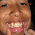 Man shows Weird Teeth