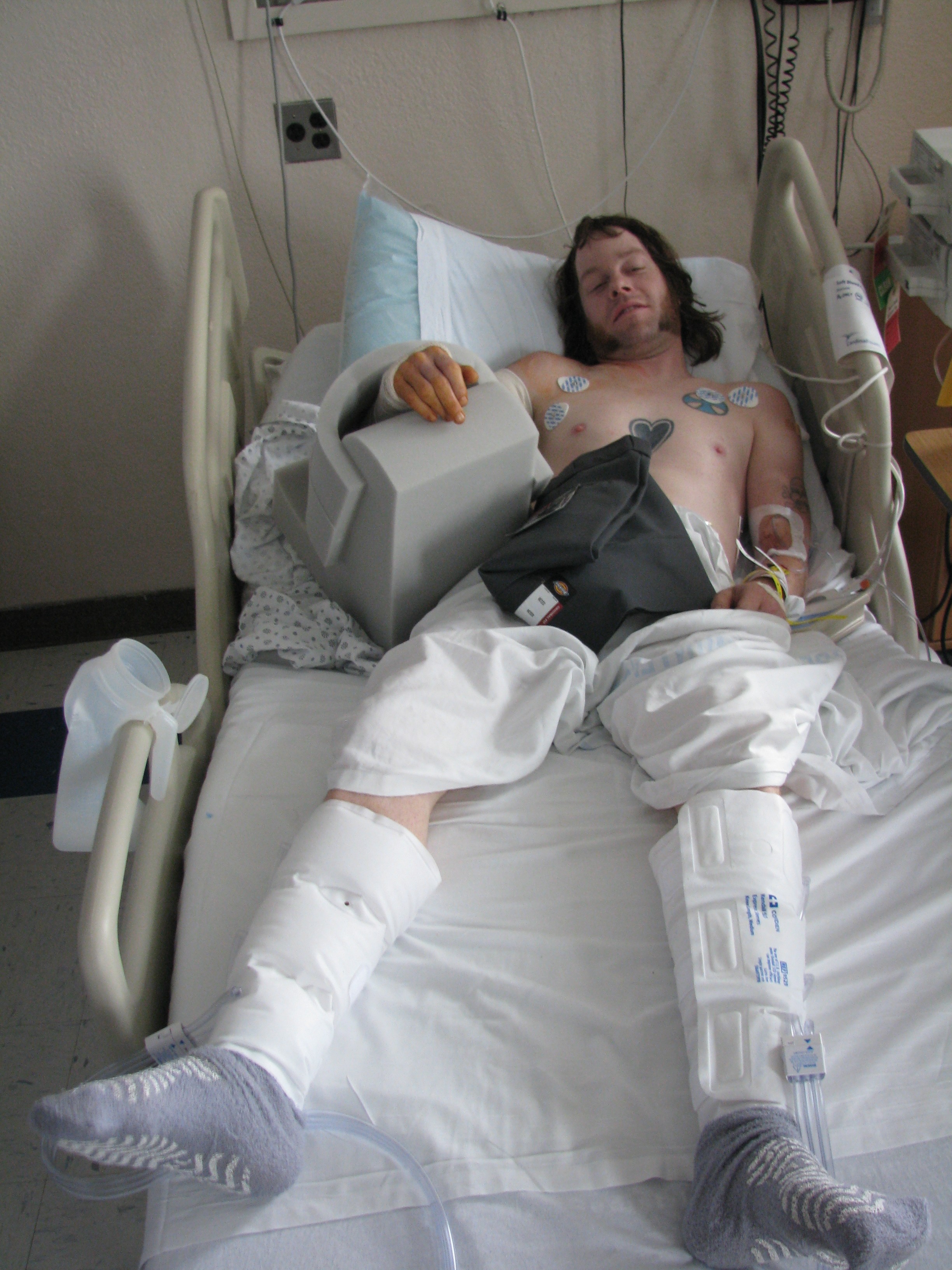 Skater bandaged up in hospital bed