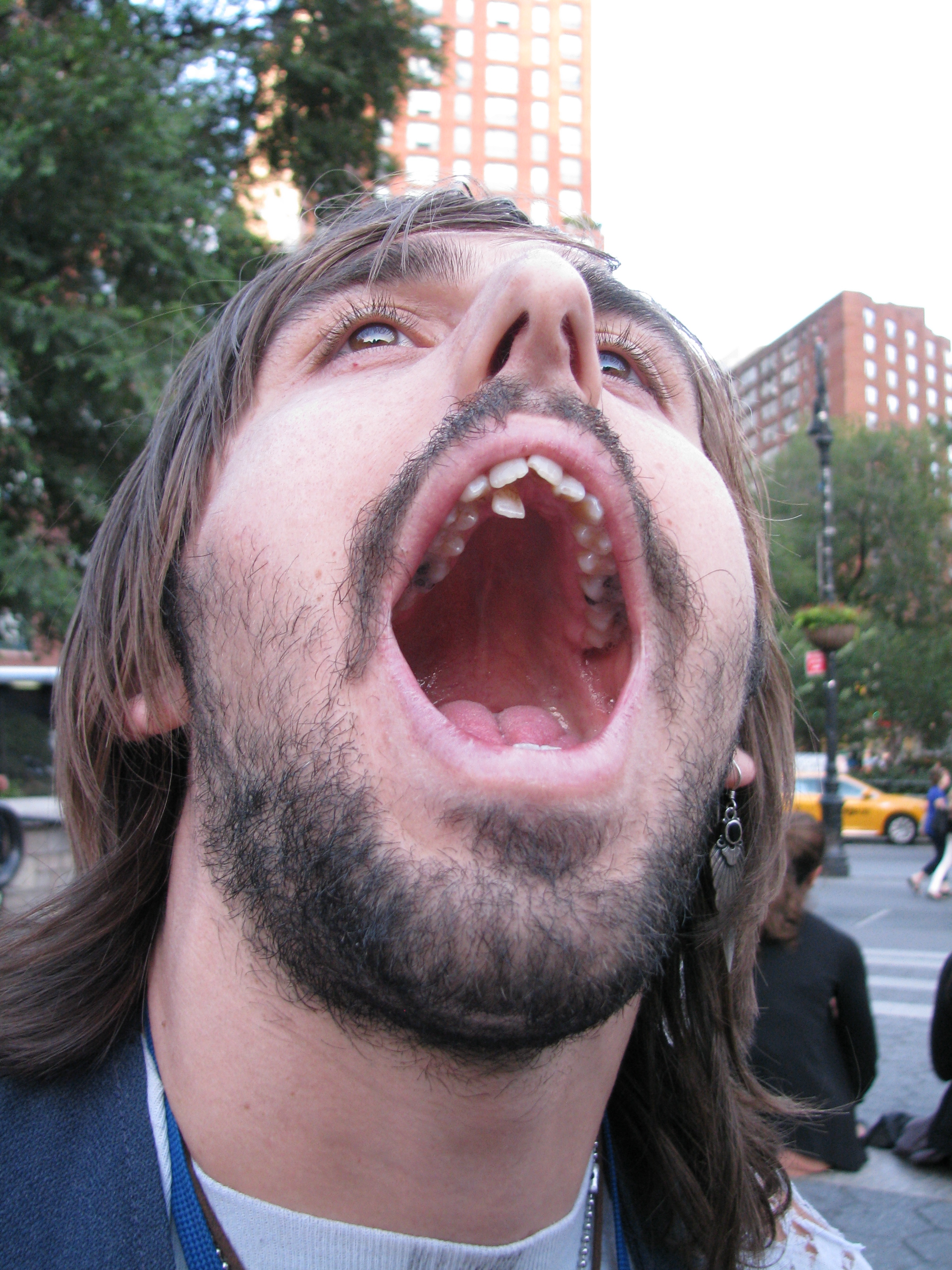 Man shows his extra tooth growing from roof of mouth